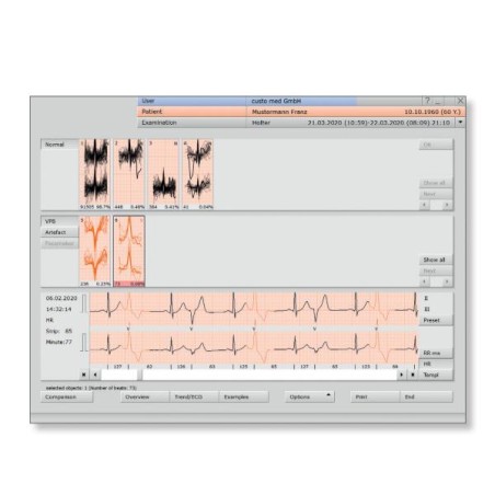 Sistema De Registo E Analise De Holter Adulto E Pediatrico