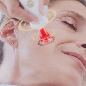 Icoone Microfacial Bioregeneração não invasiva 3D